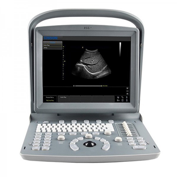 Chison ECO1 Portable Ultrasound Machine
